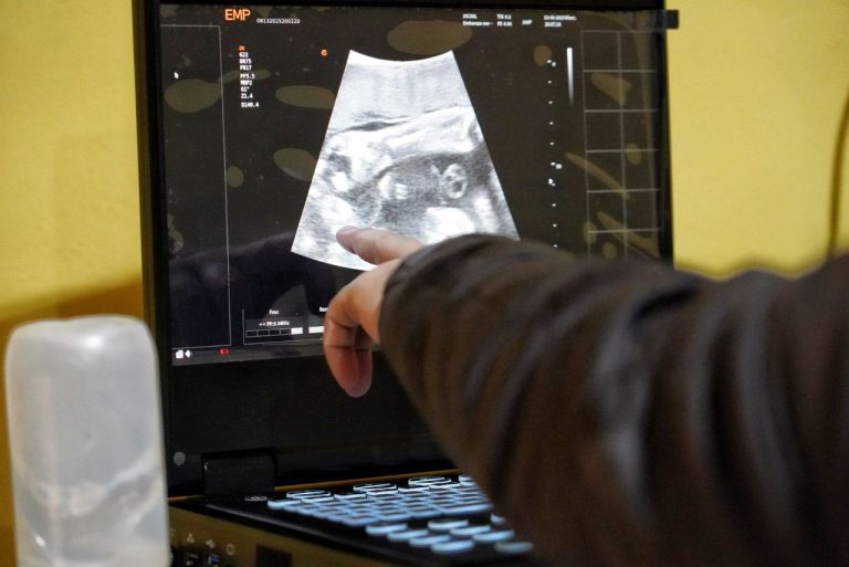 JORNADA DE SALUD Y APOYO SOCIAL LLEGA A FAMILIAS DE CAMBYRETÁ